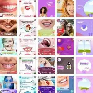 Pack Canva Dentista Odonto Templates Editável 230 Artes